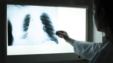 Kovid-19 akciğer hastalarında derinliğine kesiksiz halsizliğe illet oluyor