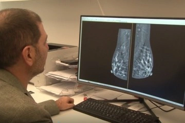 Mamografi işlemi hakkında efsaneler yeni cihazlarla sonuç buldu
